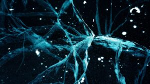 The Neuroscience of Recovery: How Your Brain Heals